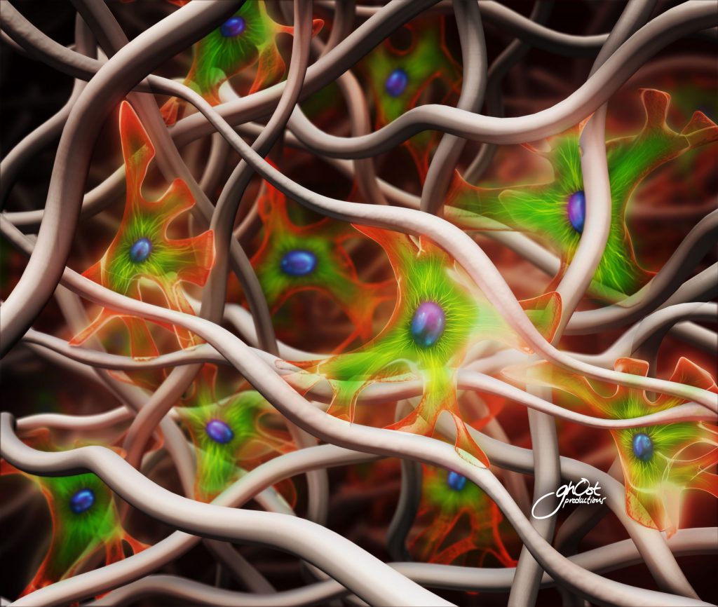 A medical illustration showing the human heart and its various chambers and valves, with labels indicating the pulmonary artery, aortic valve, mitral valve, tricuspid valve, and more. The illustration is detailed and colorful, with clear lines and shading to differentiate between different parts of the heart. This image is a helpful resource for medical professionals and patients alike to better understand the anatomy of the heart.