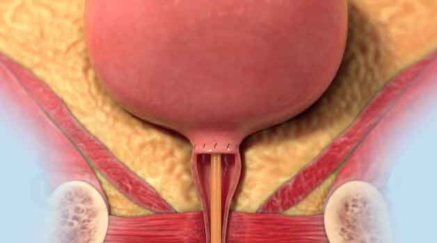 urology-gynecology; medical-illustration; animation