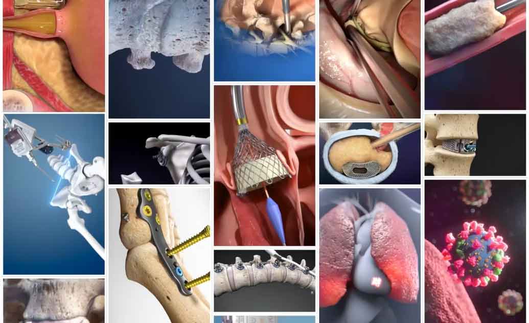 Whether you are launching a new product, rebranding your whole company, or planning your grand opening, you can trust us to deliver all of your medical marketing, training, and educational content.