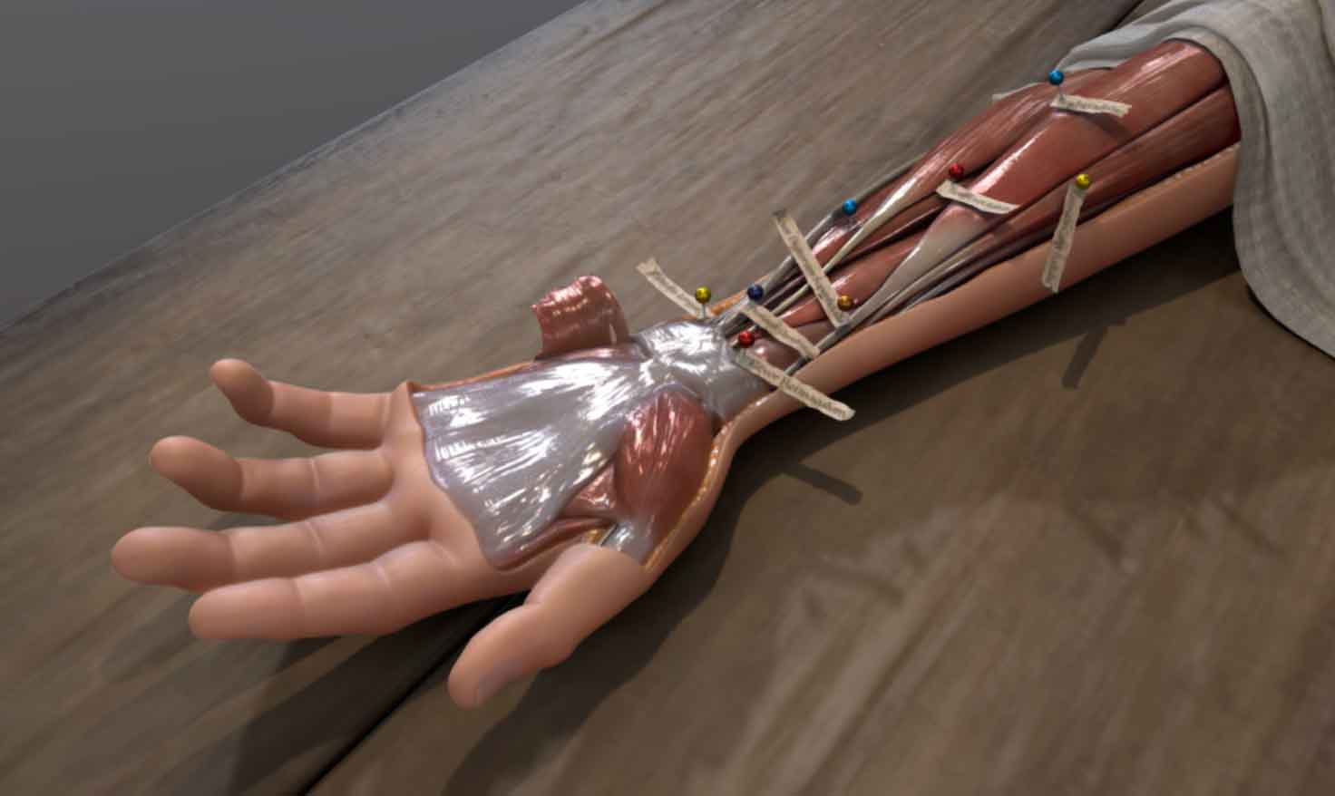 A 1543 Hand Dissection - the Corpus Humani Fabrica 