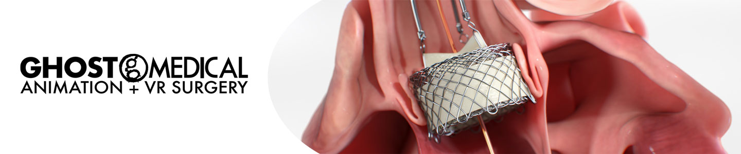 Ghost Medical Animation + VR Surgery ( Ghost Productions Inc. )  in the best medical animation studios in 2023 for medical device companies