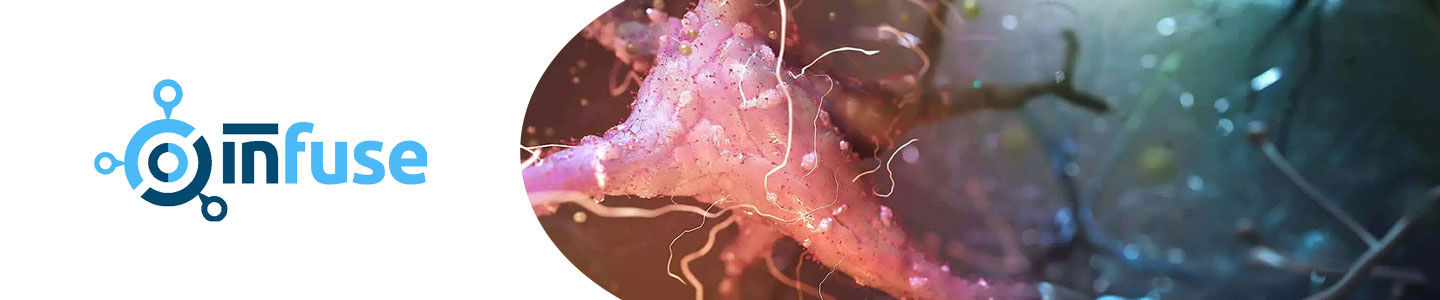 Infuse Medical Animation in the best surgery animation video companies in 2023