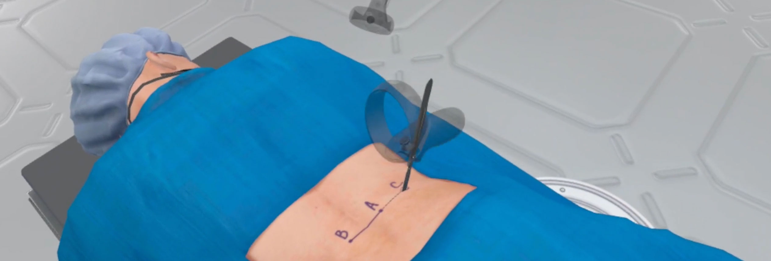 Steps Involved in Spinal Fusion Surgery Depicted through VR. Step 1 Incision. The surgeon starts by making a small skin incision at the targeted entry point using a scalpel.