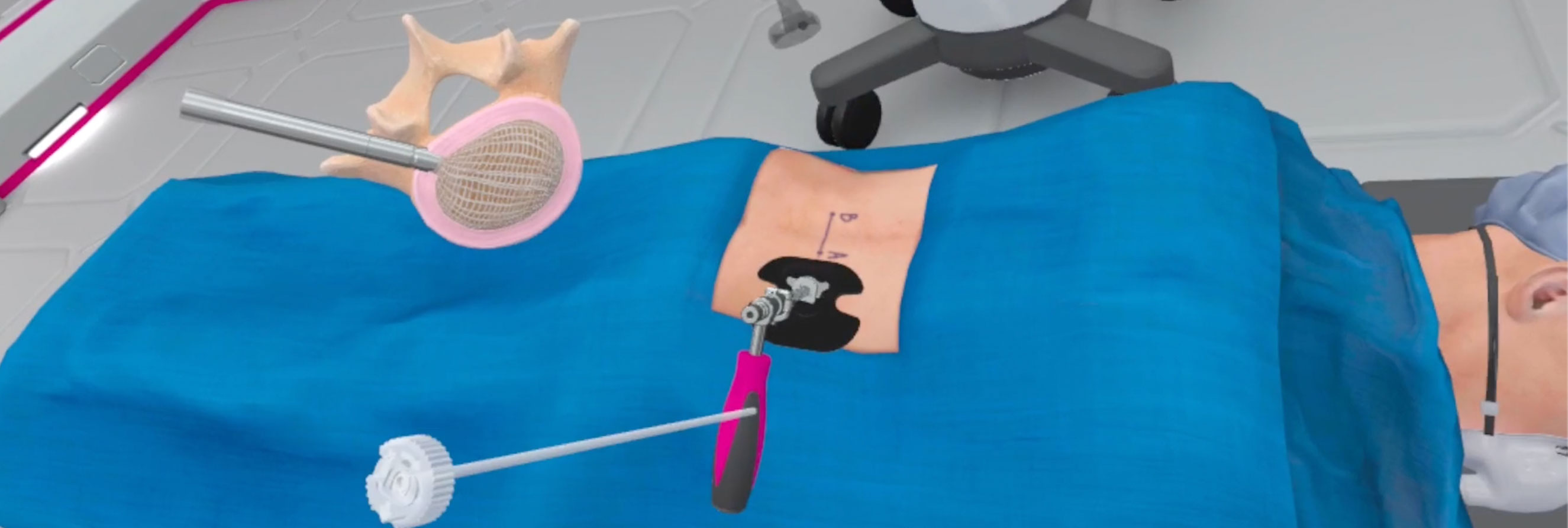 The Optimesh implant is a synthetic mesh device used to replace the damaged or removed intervertebral disk. Spineology