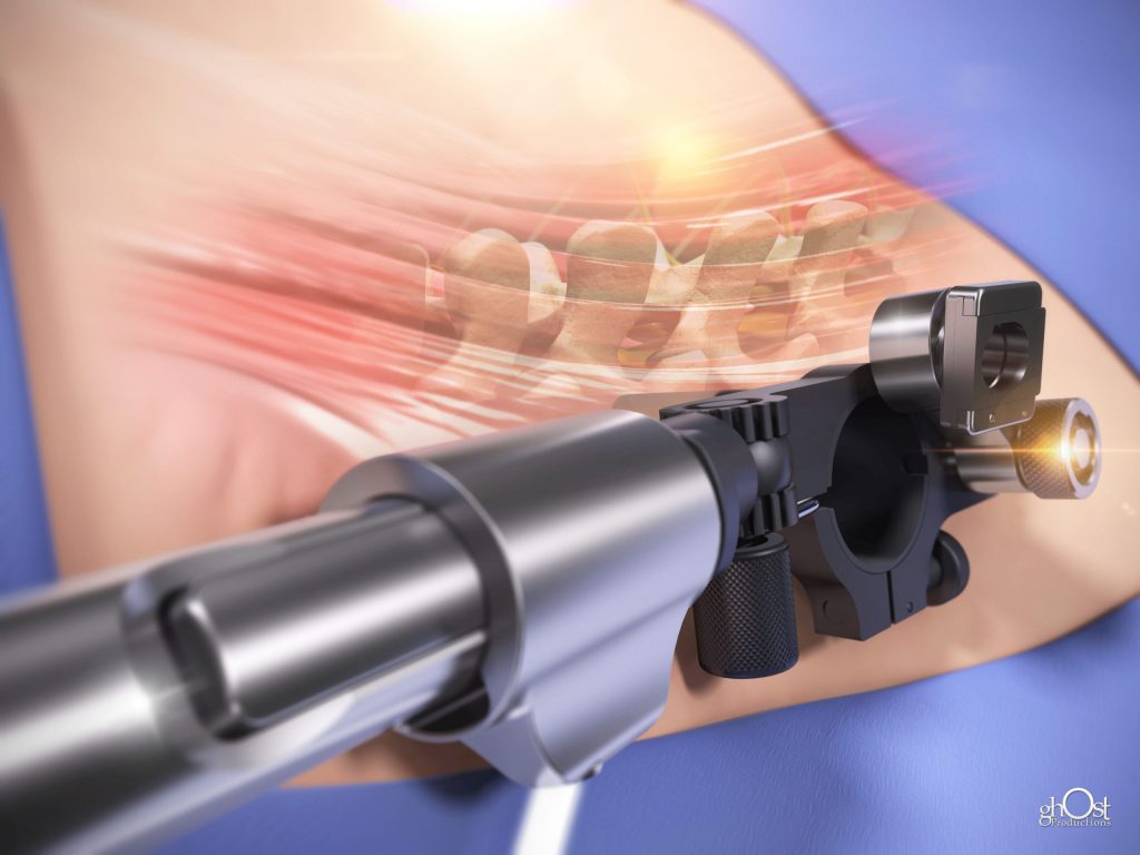 Medical Illustration in 2023: The Shift towards 3D Visualization