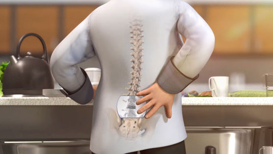 The medical illustration shows an individual expressing back pain, the spine is revealed highlighting the area of abnormality. 