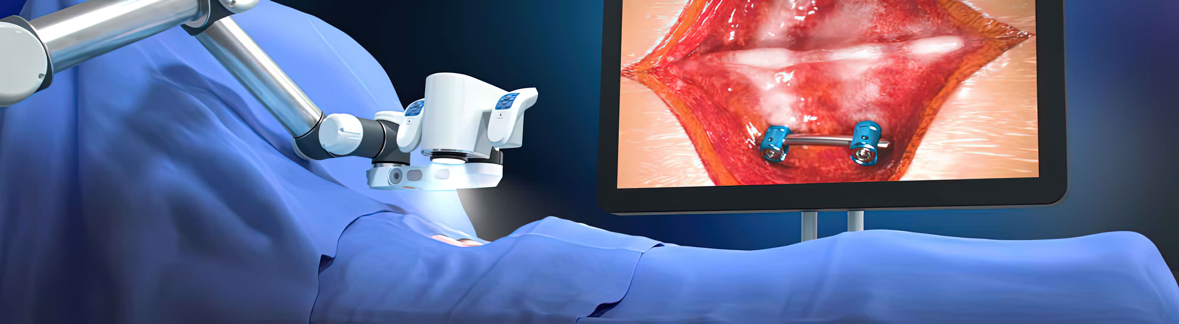 Aesculap Aeos Robotic Digital Microscope shown in a medical animation by Ghost Productions. Combines exoscope benefits with high-quality imaging and fluorescence capabilities of optical microscopes. Features digital and robotic functions for precise medical imaging.