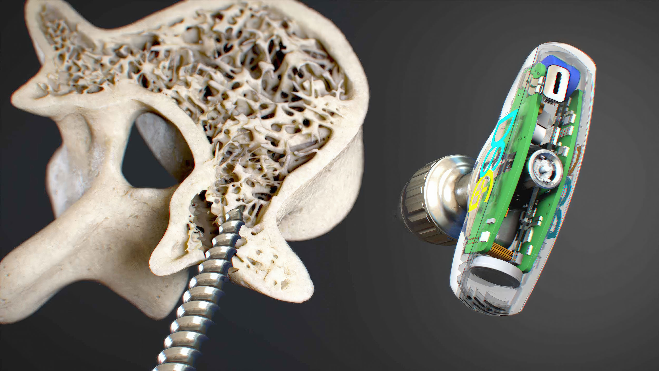 A medical device illustration displaying intricate design and functionality. Valuable resource for medical education and training. High-quality resolution and attention to detail. Essential addition to any medical image database.