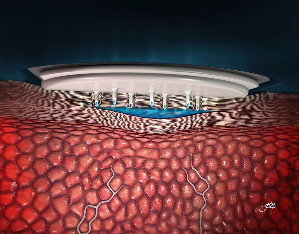 A range of 3M medical devices are displayed, including surgical tapes, dressings, wound care products, and skin protectants. These devices are made with advanced materials and technologies to provide superior performance and patient comfort. Trusted by healthcare professionals worldwide, they deliver optimal patient care outcomes.