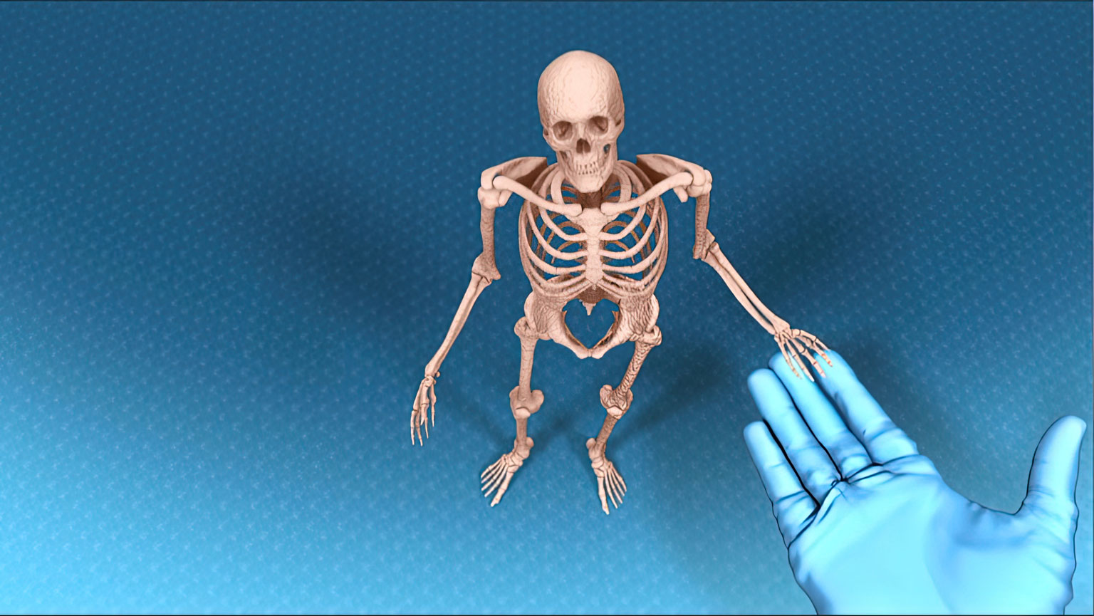 Orthofix Trinity ELITE HD: a spinal fusion system with high-definition imaging for precise surgical procedures. Advanced technology promotes optimal patient outcomes and faster recovery times. Ideal for orthopedic surgeons who demand top performance and reliability.