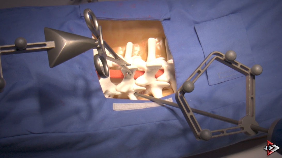 SeaSpine's Interview of the 7D Flash System at NASS 2023 