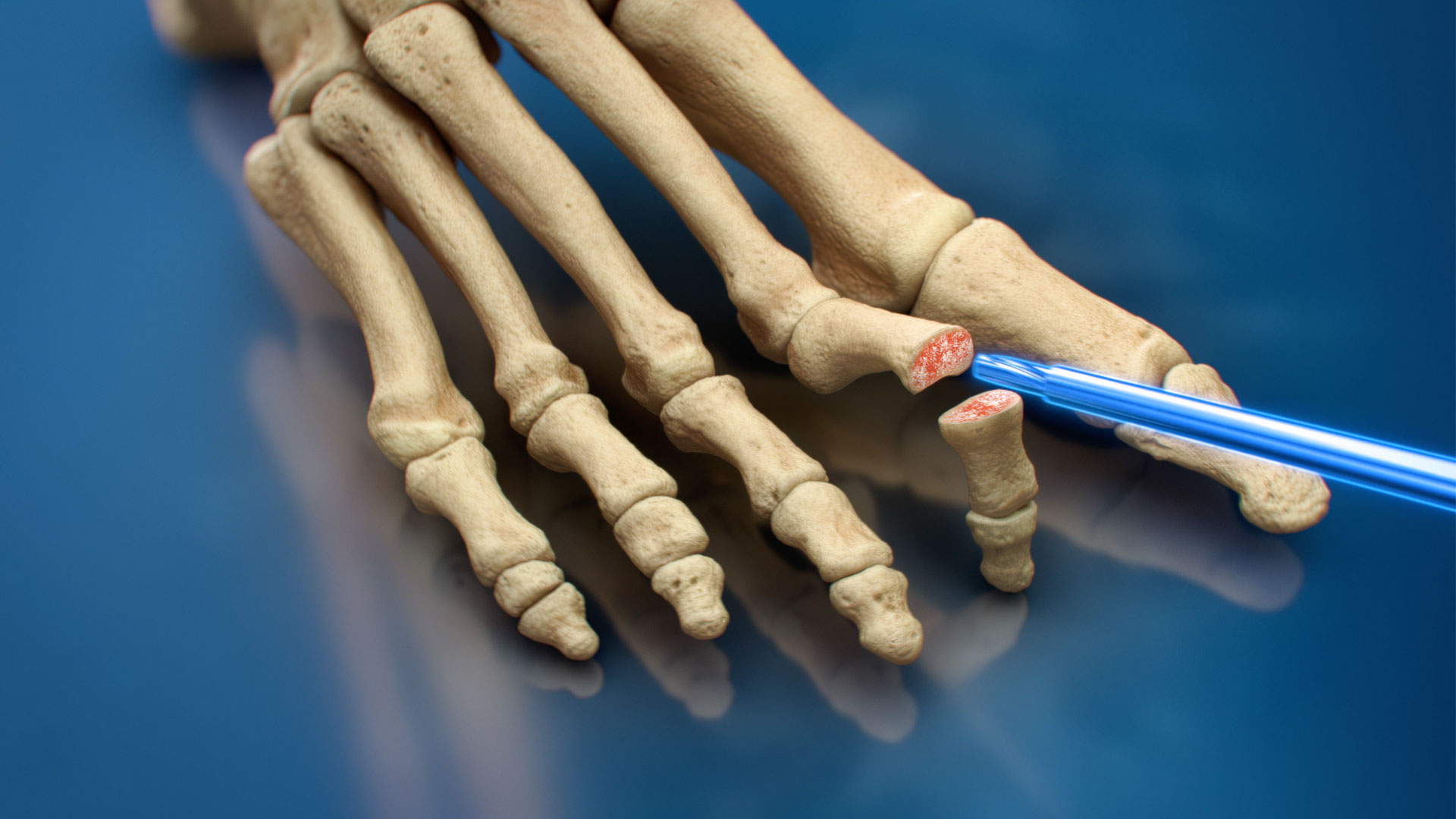 2024 Medical Animation Reel - Ghost Medical | Video