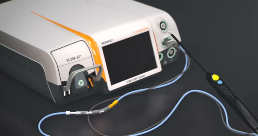 Coblation Werewolf System - Smith + Nephew | Animation 2018 | Video