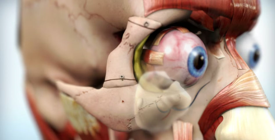Exploring Oculoplastic, Orbital Surgery, ENT, and Skull Surgery | Video