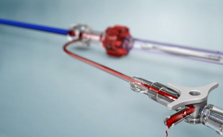 CardioKinetix, PARACHUTE® device, medical animation, Ghost Medical, collaboration, innovative, transformative potential, Ventricular Partitioning Device, heart failure, transcatheter implant, CardioKinetix headquarters, Menlo Park, CA, global scale, disease burden, United States, economic impact, invasive treatments, Redwood City, USA, revolutionary approach, healthcare, Ghost Productions, surgical VR simulation, medical accuracy, graphics, animations, virtual surgery, informative, inspiring, market, educate patients, mechanism of action, pharmaceutical product, expertise, resources, exceptional results, competitive prices, complex information, 3D anatomy, physiology, breathe life, medical project.