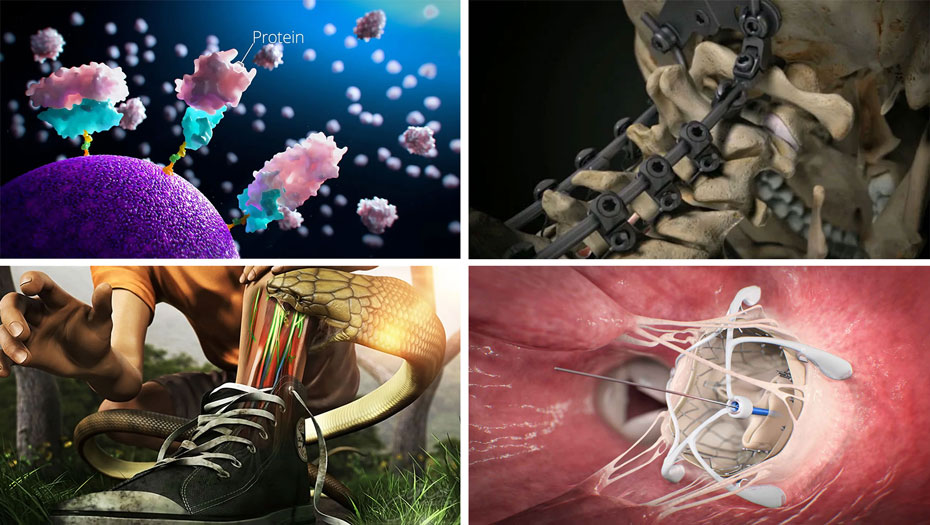 Medical animation Stills for How to Sell Your Medical Device: The Best Methods for Success